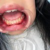 お嬢様は肉便器 生田りん ＃アナル ＃ゲロ ＃開口器 ＃ハードイラマチオ - サンプル画像 - 12